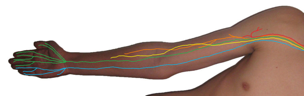 Brachial_plexus_anterior_view_nerves-NEW